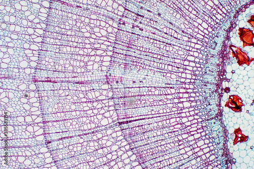 Xylem is a type of tissue in vascular plants that transports water and some nutrients. photo