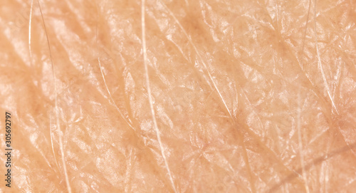 Human skin as a background