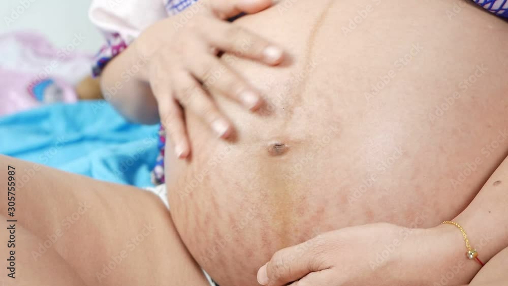 Hands rubbed pregnant belly with pregnant stretch marks or scar. Hands rubbed pregnant belly with pregnant stretch marks or scar.