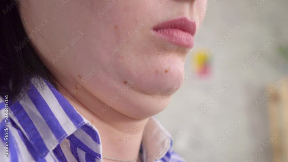 Close up double chin of a young woman