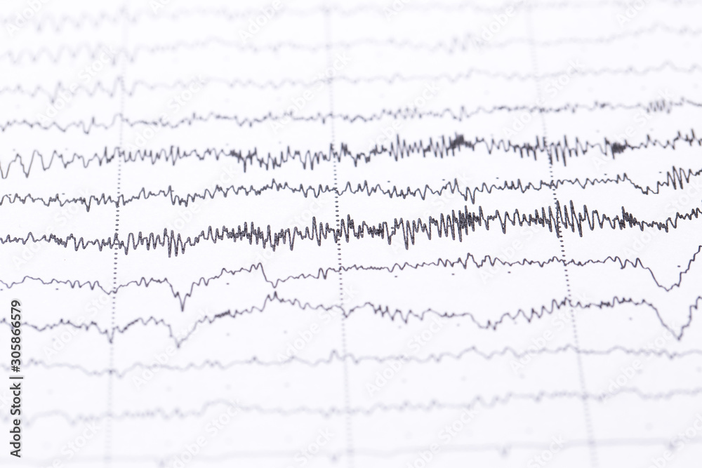 Cardiogram on a sheet of paper close-up. Texture of pulsed waves. Cardiogram on a sheet of paper close-up. Texture of pulsed waves.