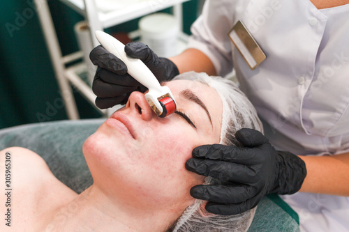 Doctor cosmetologist makes facial massage procedure using a dermo roller. Woman in beauty salon during mesotherapy procedure with mesoscooter photo
