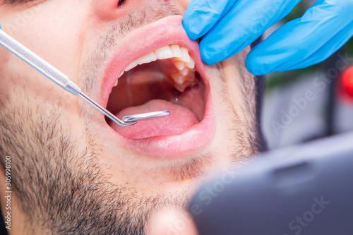 dentist with tools working on the patient s mouth
