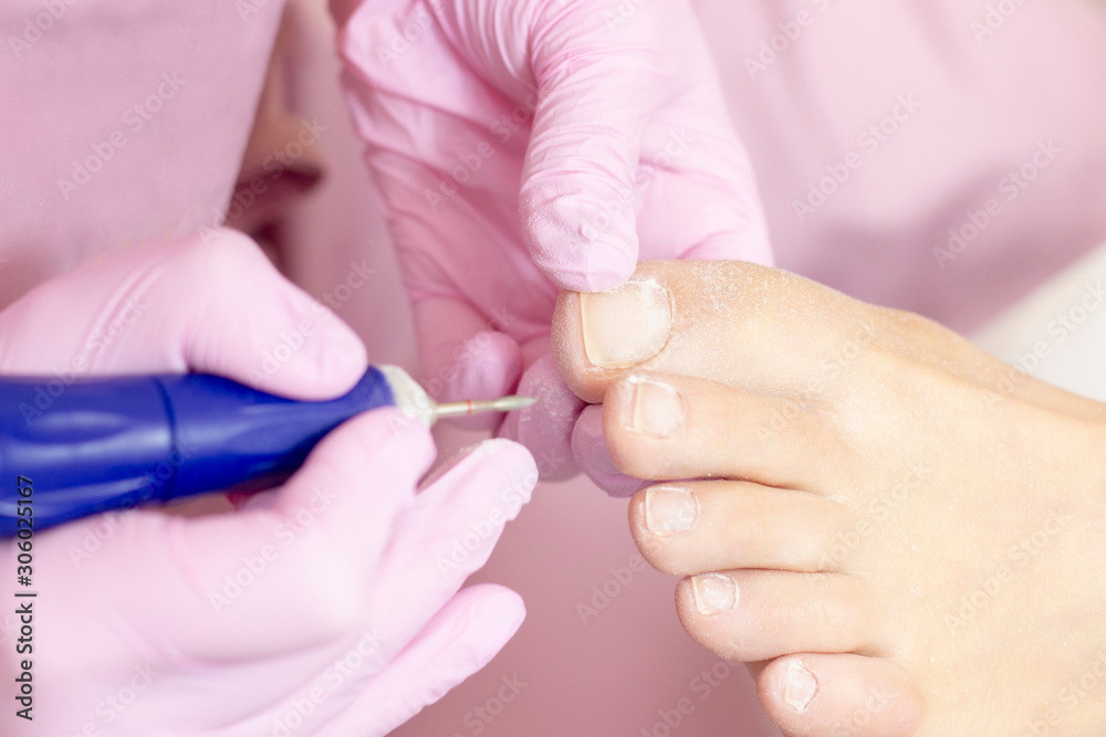 Professional hardware pedicure using an electric machine. Patient at the pedicure procedure. polishing the nail plate, processing the cuticle using a pedicure machine.