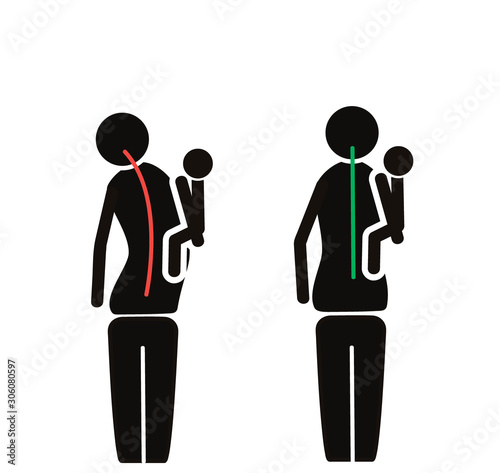icon. correct and incorrect posture when carrying a child. EPS 10 vector illustration.