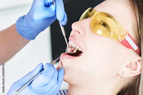 A close-up of the girl's face is examined by a dental examiner with his mouth open and a napkin and eyes closed. Dentist hands with inspection tools