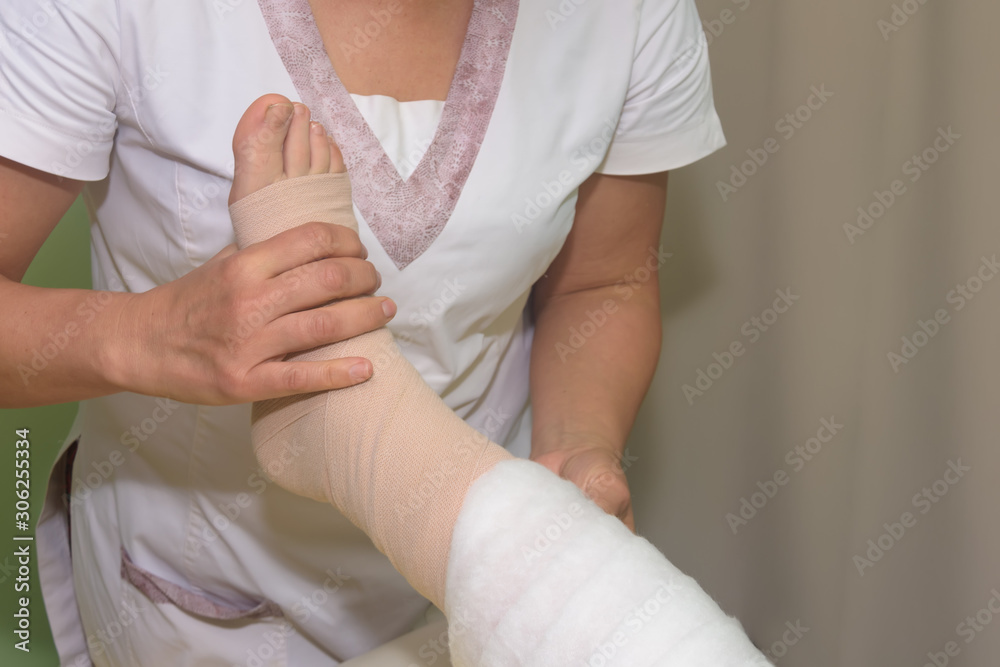 Lymphedema management Wrapping leg using multilayer bandages to