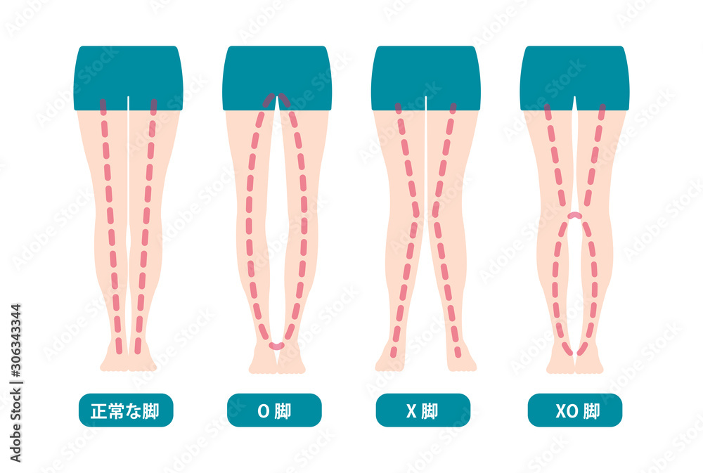 Difference types of legs angles and knees vector illustration (Japanese