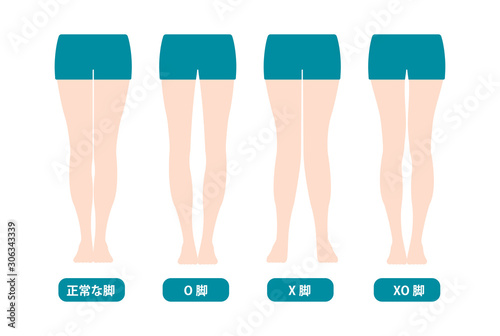 Difference types of  legs angles and knees vector illustration (Japanese) 