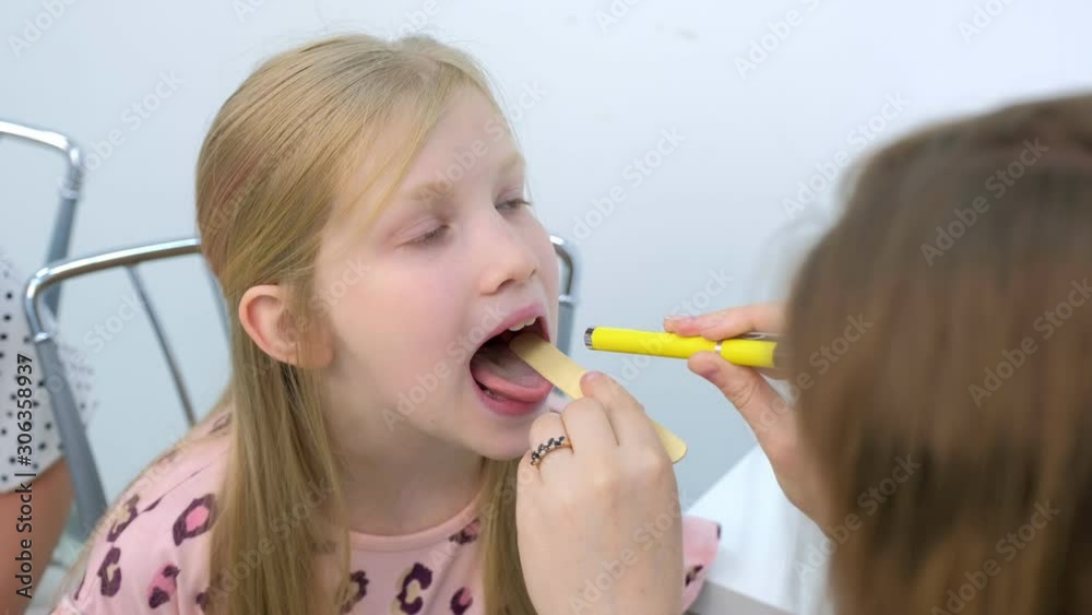 Medicine for children and healthcare concept. Pediatrician looking child girl throat using spatula and lantern, portrait of child. Preventive examination in clinic. Diagnostics tonsillitis or angina. Medicine for children and healthcare concept. Pediatrician looking child girl throat using spatula and lantern, portrait of child. Preventive examination in clinic. Diagnostics tonsillitis or angina.