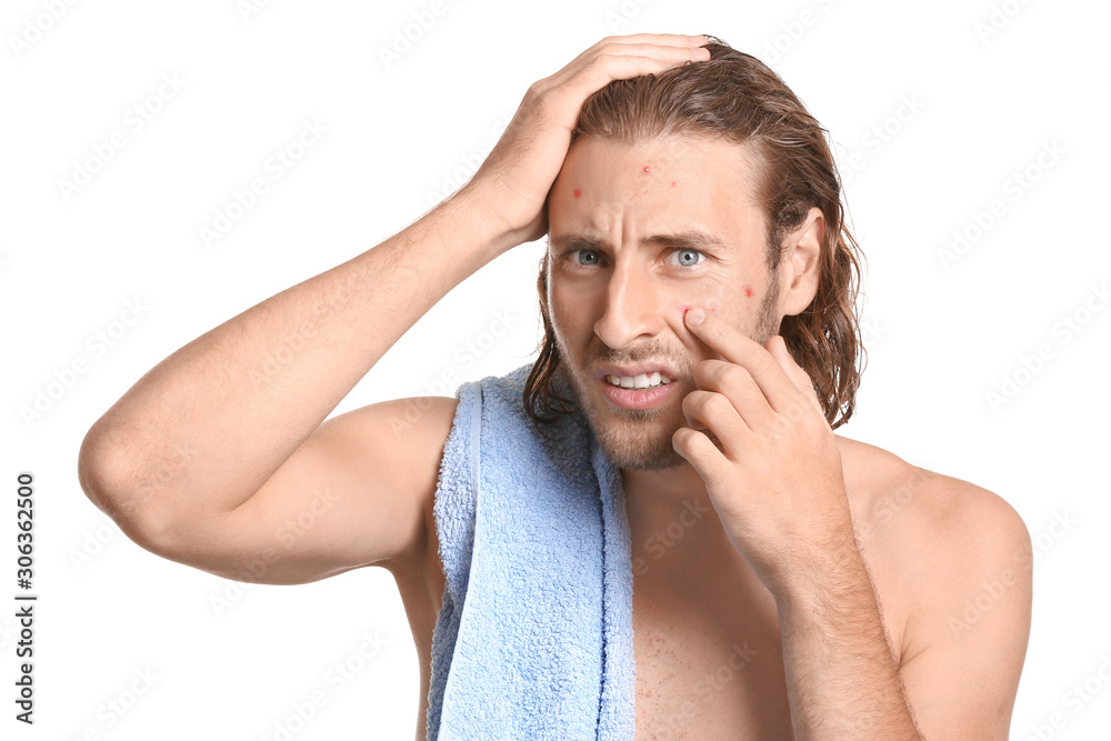Portrait of young man with acne problem on white background Portrait of young man with acne problem on white background