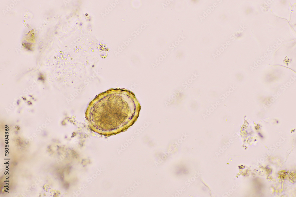 roundworm in stool