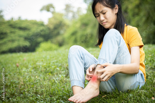 Asian child girl scratching itch on her leg with hand,female teenage with red rash,mosquito bite,fungal infection,insect bites,legs itching allergy,rash while sitting on the grass at park,Anaphylaxi photo