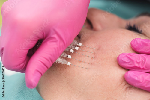 Mono PDO Threads face lifting