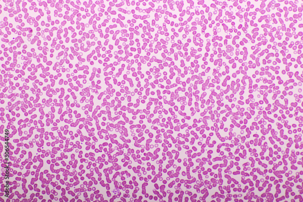 Red blood cells in blood smear, Wright-Giemsa stain, analyze by microscope, 400x Red blood cells in blood smear, Wright-Giemsa stain, analyze by microscope, 400x