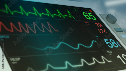 closeup view of an ecg ekg monitor on a operating room photo