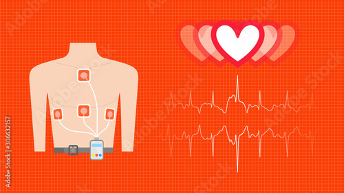 Electrocardiogram