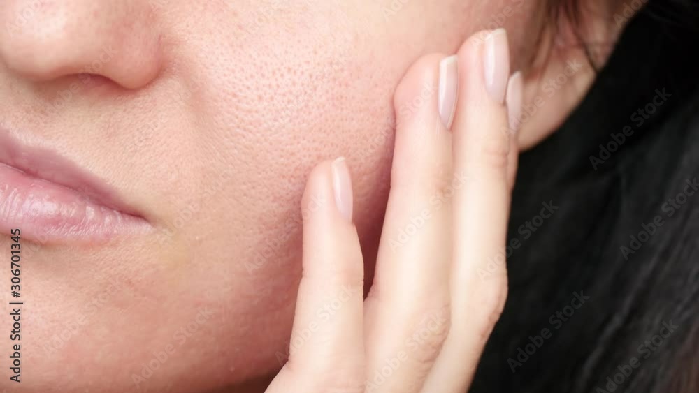 Female face close-up. Texture of problem skin with enlarged pores. The woman touches the skin of her face with her hands, examining it. Female face close-up. Texture of problem skin with enlarged pores. The woman touches the skin of her face with her hands, examining it.