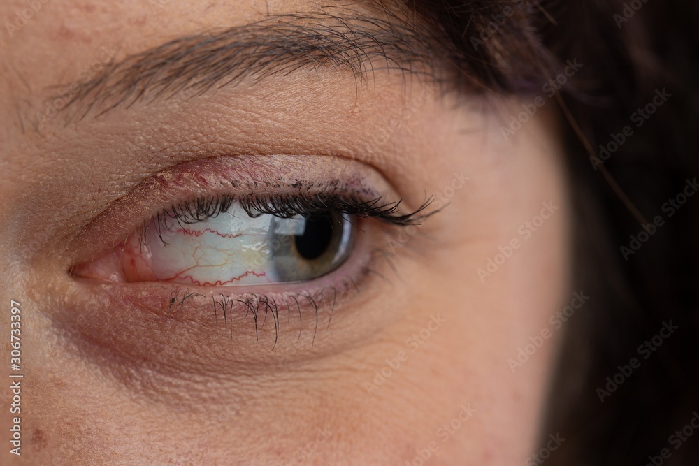 Close-up of a gray eye of a girl looking to the left Close-up of a gray eye of a girl looking to the left