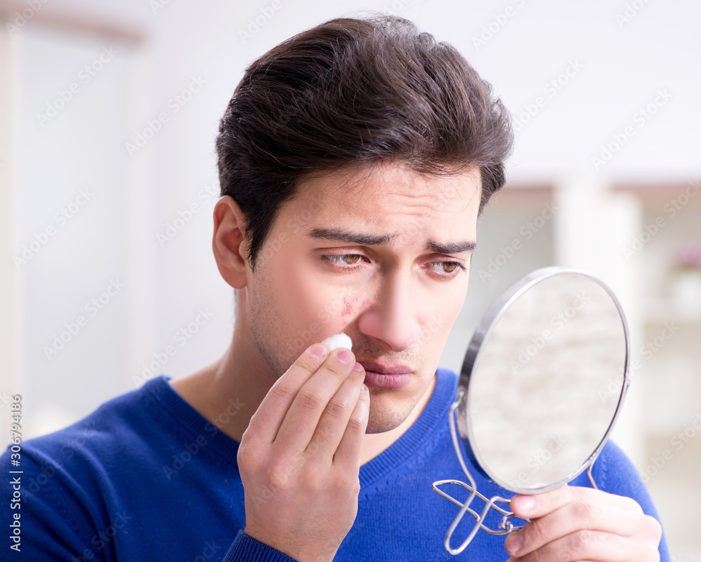 Man panicking because of pimples on the skin Man panicking because of pimples on the skin