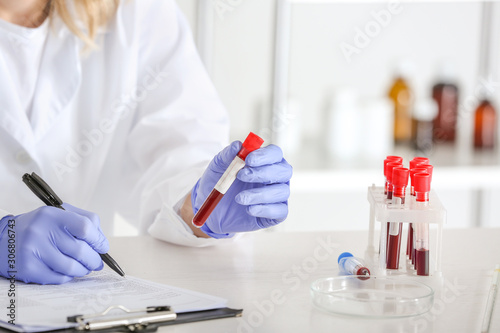 Woman working with blood sample in laboratory, closeup