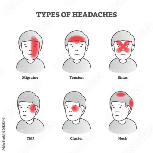 Types of headaches vector illustration. Labeled educational brain pain set.