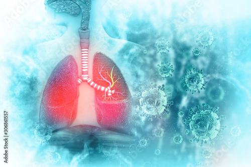 Canvas Print Virus and bacteria infected the Human lungs