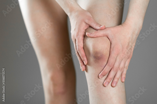 The bruise on his knee. Knee pain. The woman holds her leg. Close up