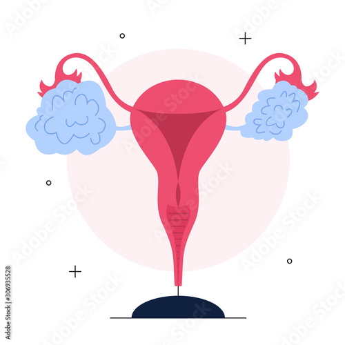 Ovarian cancer signs. Idea of health and medical treatment. Female reproductive