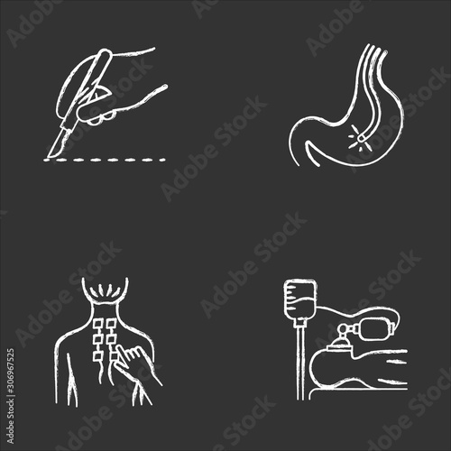 Medical procedure chalk icons set. Surgery. Endoscopy and gastroscopy. Digestive tract check. Physiotherapy. Back pain relief. Anesthesia. Clinical aid. Isolated vector chalkboard illustrations