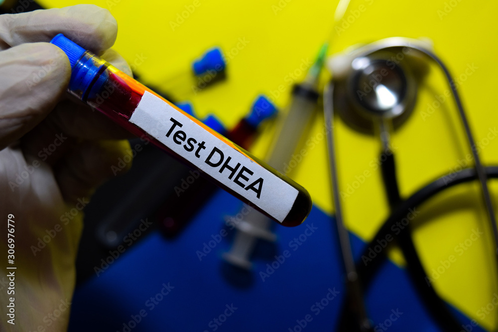 Test Dhea text with blood sample. Top view isolated on office desk