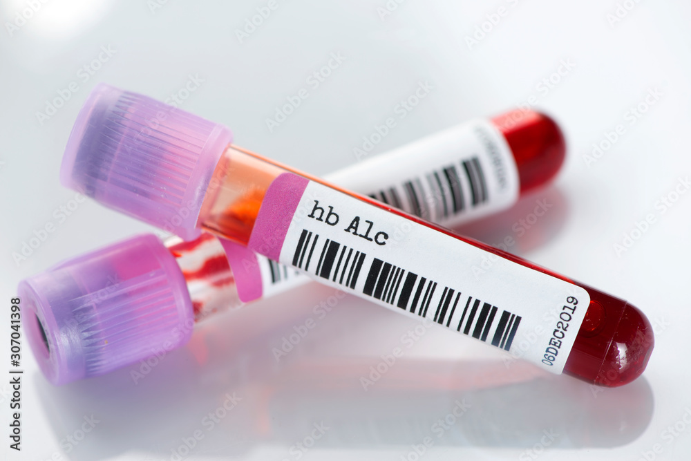 Obraz premium Hemoglobin A1c Blood Test