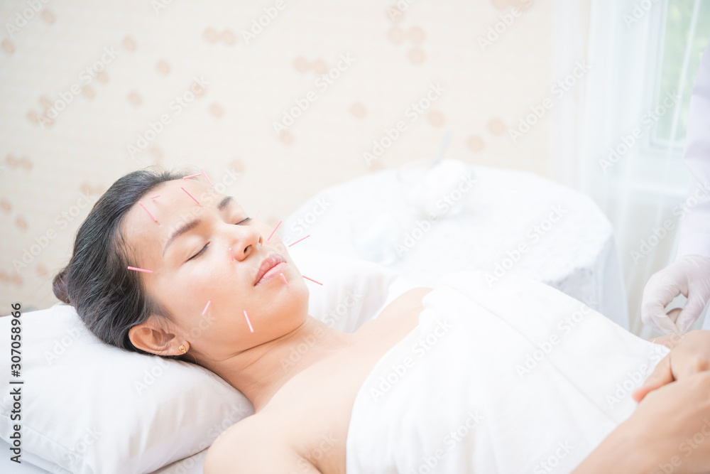 Woman receiving facial acupuncture treatment Woman receiving facial acupuncture treatment