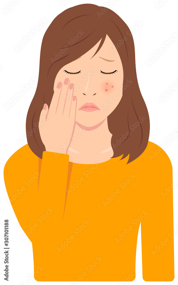 Young asian woman vector illustration (upper body,waist up) / acne, pimple, treckles, rash Young asian woman vector illustration (upper body,waist up) / acne, pimple, treckles, rash
