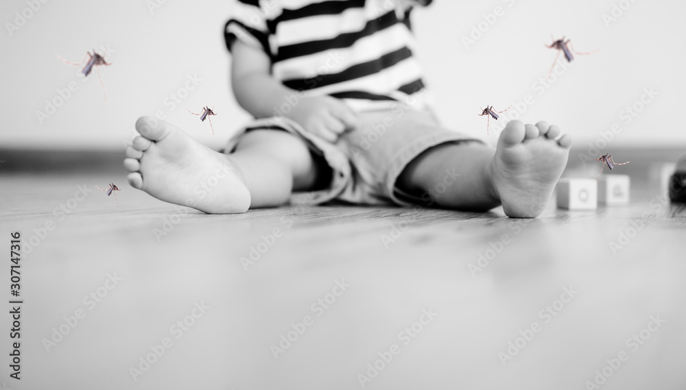 Little Asian toddler boy has allergies with mosquitoes bite and itching