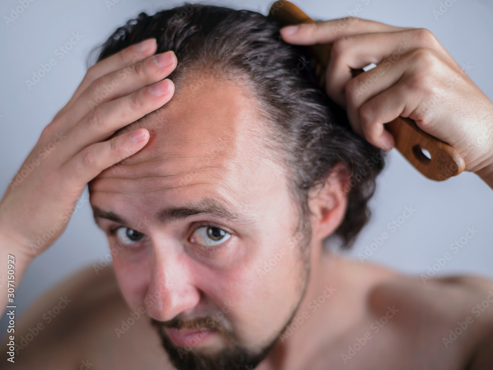 Obraz premium Portrait of a young guy with magnificent hair that falls early on his forehead. The problem of premature aging. Combing hair and indignantly looking in the mirror