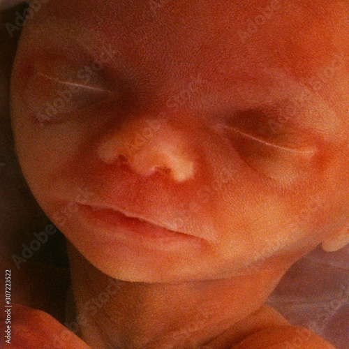 Canvastavla In vitro image of a human fetus in the womb