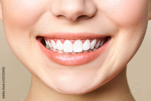 Perfect healthy teeth smile of a young woman. Teeth whitening. Dental clinic patient. Image symbolizes oral care dentistry  stomatology. Dentistry image.