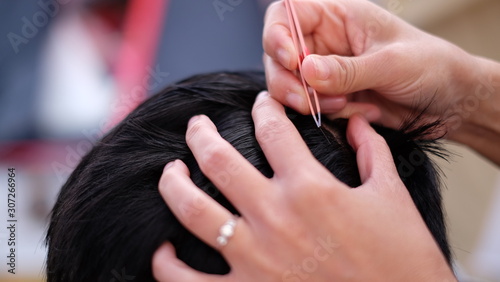 Close up gray&white hair removal from the scalp of a Middle-aged men , using tweezers