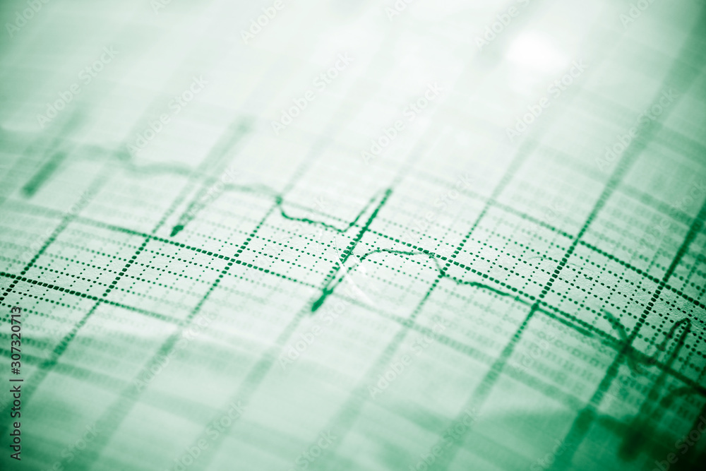 Electrocardiogram close up Electrocardiogram close up
