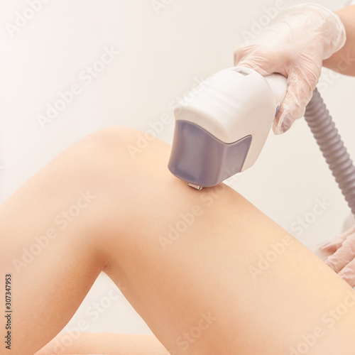 Laser elos medical device. Remove unwanted hair and asteriks. Cosmetology spa procedure at salon. Doctor laser leg depilation. Perfect treatment photo