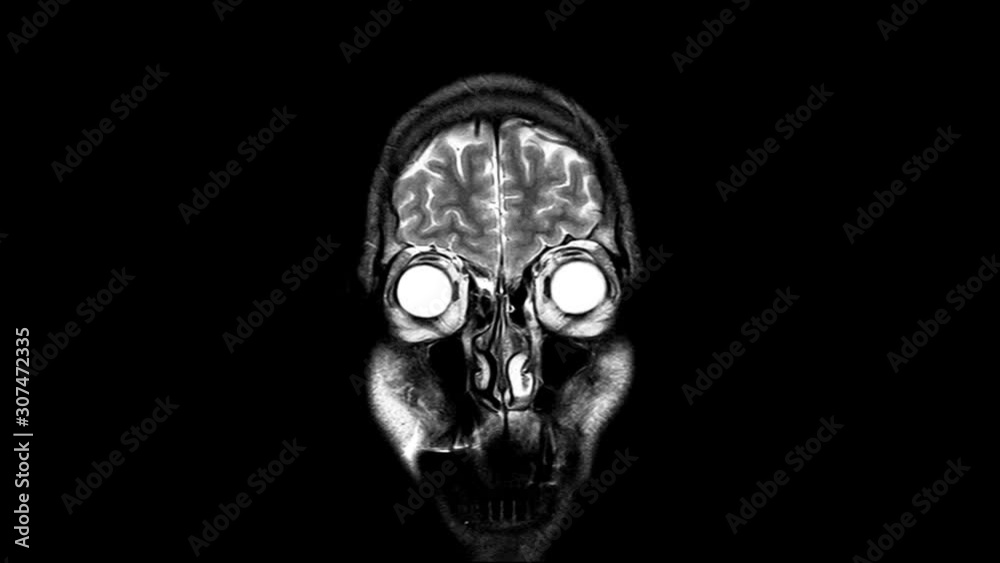 Human Brain MRI Scan from Front,  X-ray  - XRay Magnetic Resonance imaging of a brain, Ultra HD 4k, Time Lapse