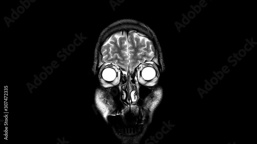 Human Brain MRI Scan from Front,  X-ray  - XRay Magnetic Resonance imaging of a brain, Ultra HD 4k, Time Lapse
