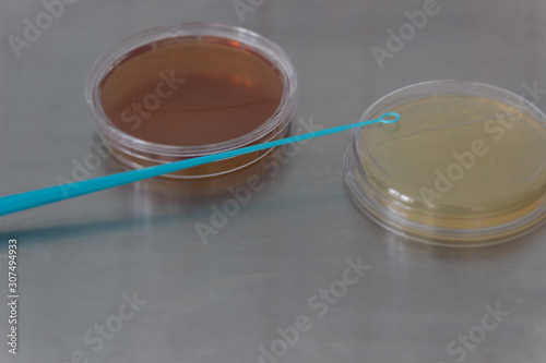 petri dish medium for microbial research.
