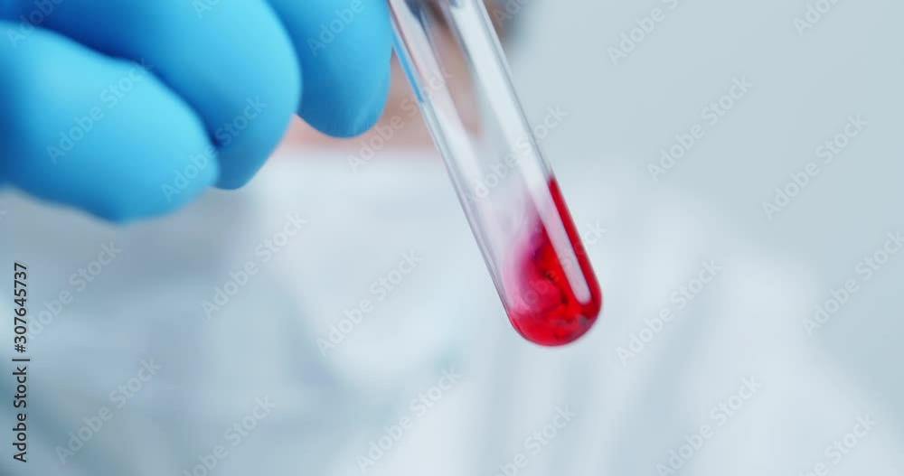 Crop shot of medical worker of the laboratory carefully examines the serum in a glass tube and shakes it Crop shot of medical worker of the laboratory carefully examines the serum in a glass tube and shakes it