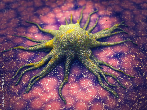 Фотография Cancer cell invading tissue, Cancer metastasis is the spreading of malignant cel