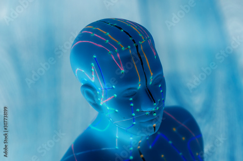 Quadro su tela Medical acupuncture model of human