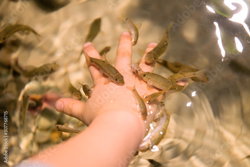 Doctor fish (Garra rufa) around the child's hand.