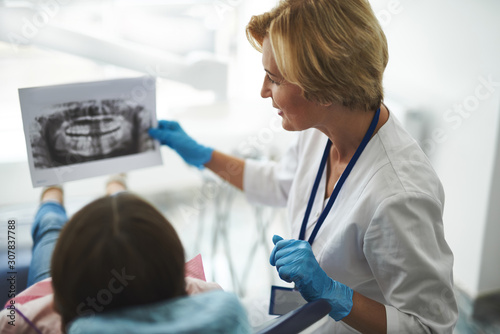 Pleasant nice female dentist holding a dental scan