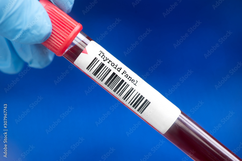 Thyroid panel blood test. A thyroid panel is a group of tests that may
